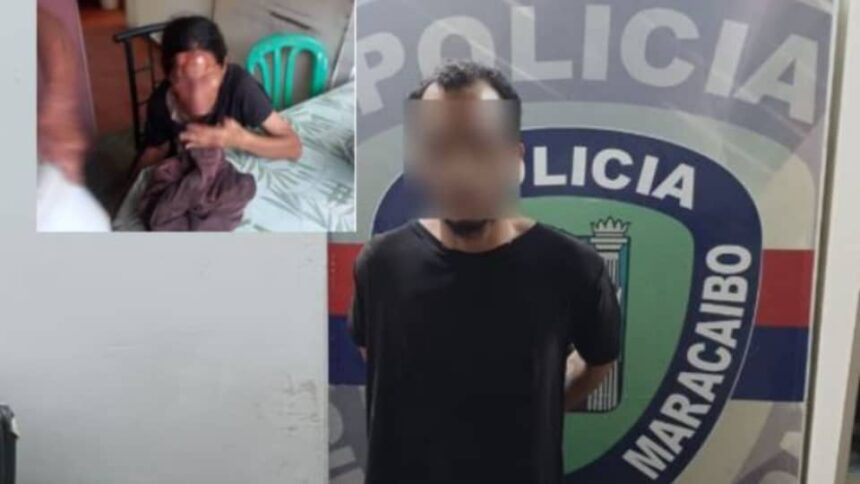 EN ZULIA | Le dio brutal paliza a su madre porque no quiso darle dinero para comprar droga