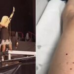 EN VIDEO: Cantante fue mordida por un murciélago en pleno concierto de AC/DC en España